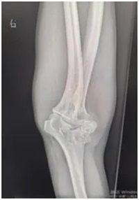 640 (1)_副本 640 (1)_副本