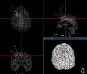 640 (3)_副本 640 (3)_副本